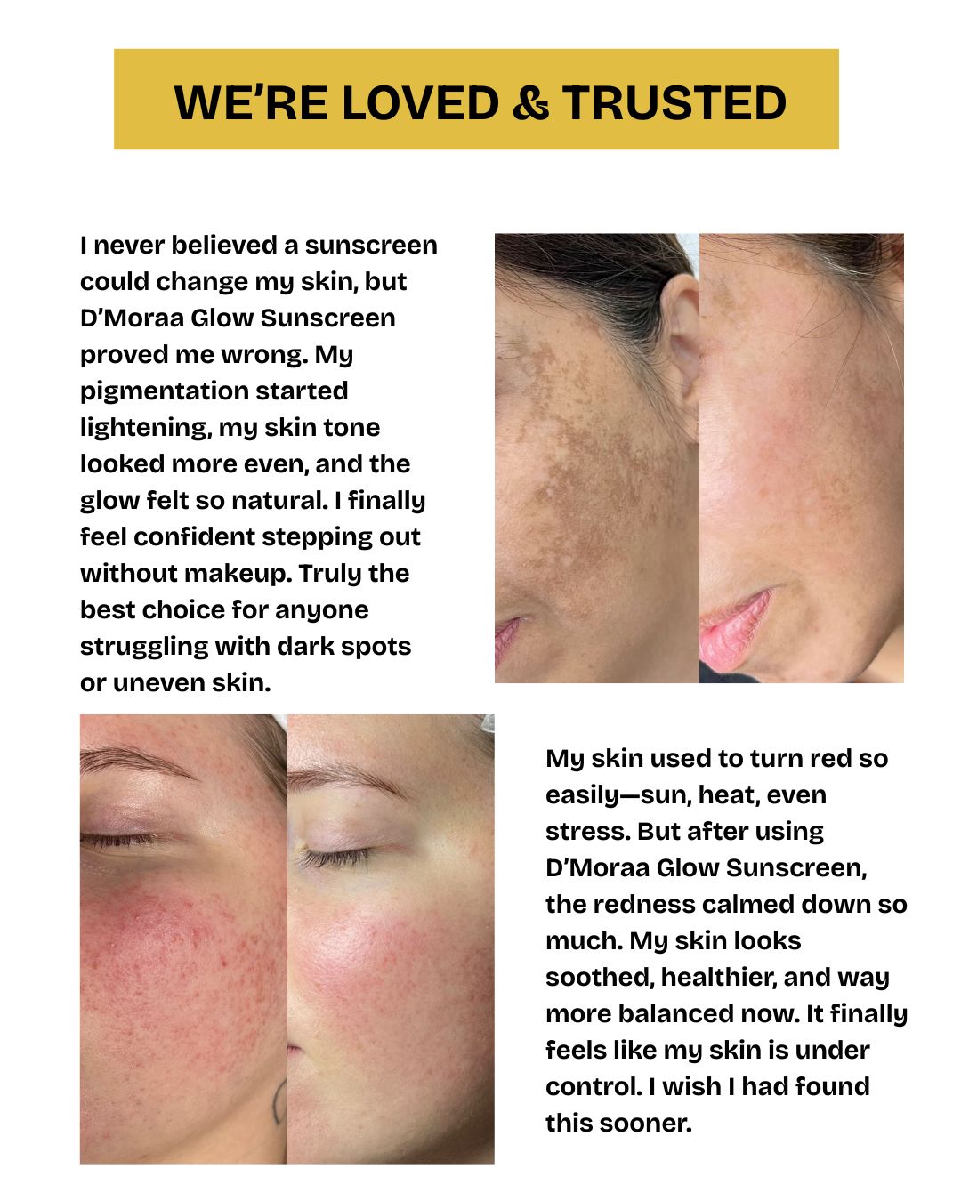 Glow++ Hydrating Ozonated Water Sunscreen SPF 50+ PA+++ | All Skin Types - 50g