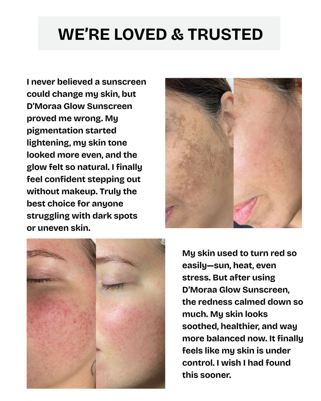 Glow++ Hydrating Ozonated Water Sunscreen SPF 50+ PA+++ | All Skin Types - 50g